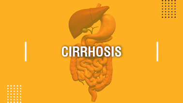 Peers Alley Media: Cirrhosis