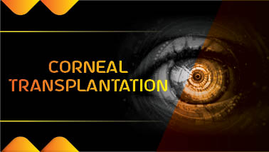 Peers Alley Media: Corneal Transplantation