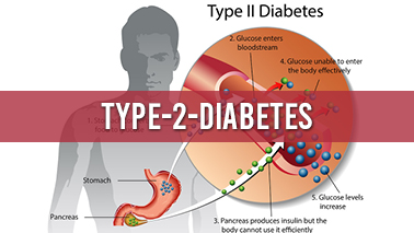 Peers Alley Media: Diabetes mellitus type 2