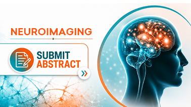 Peers Alley Media: Neuroimaging