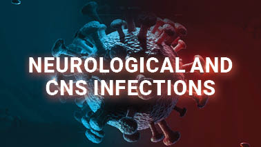 Peers Alley Media: Neurological and CNS Infections