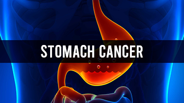 Peers Alley Media: Stomach Cancer