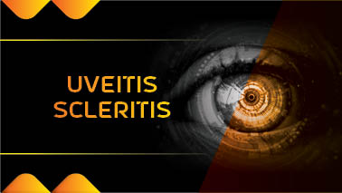 Peers Alley Media: Uveitis Scleritis