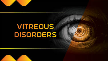 Peers Alley Media: Vitreous Disorders
